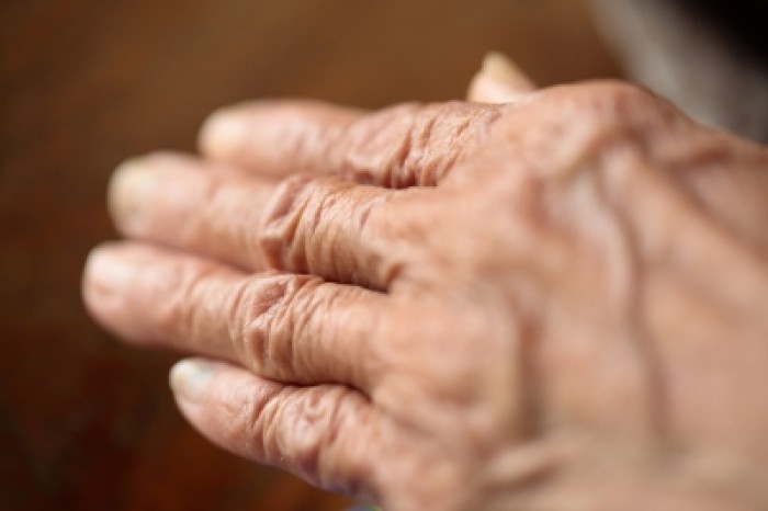 Bóle kręgosłupa u seniorów. Zwyrodnienie stawów, dyskopatia, stenoza. Co robić?