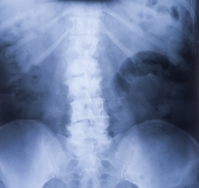 Rentgen czy rezonans? Co wybrać w diagnostyce bólu kręgosłupa?